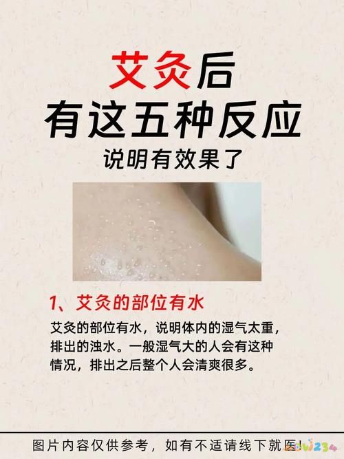 養生艾灸多久做一次合適_艾灸養生_養生艾灸儀怎么用視頻